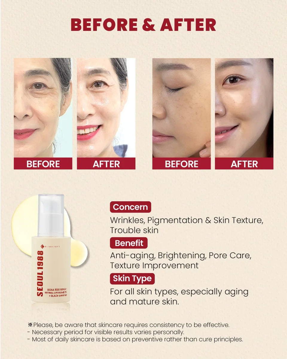 Seoul 1988 Serum Retinal Liposome 2% - BLACK GINSENG